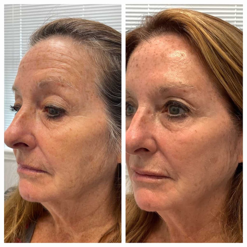 GlowLift Serum